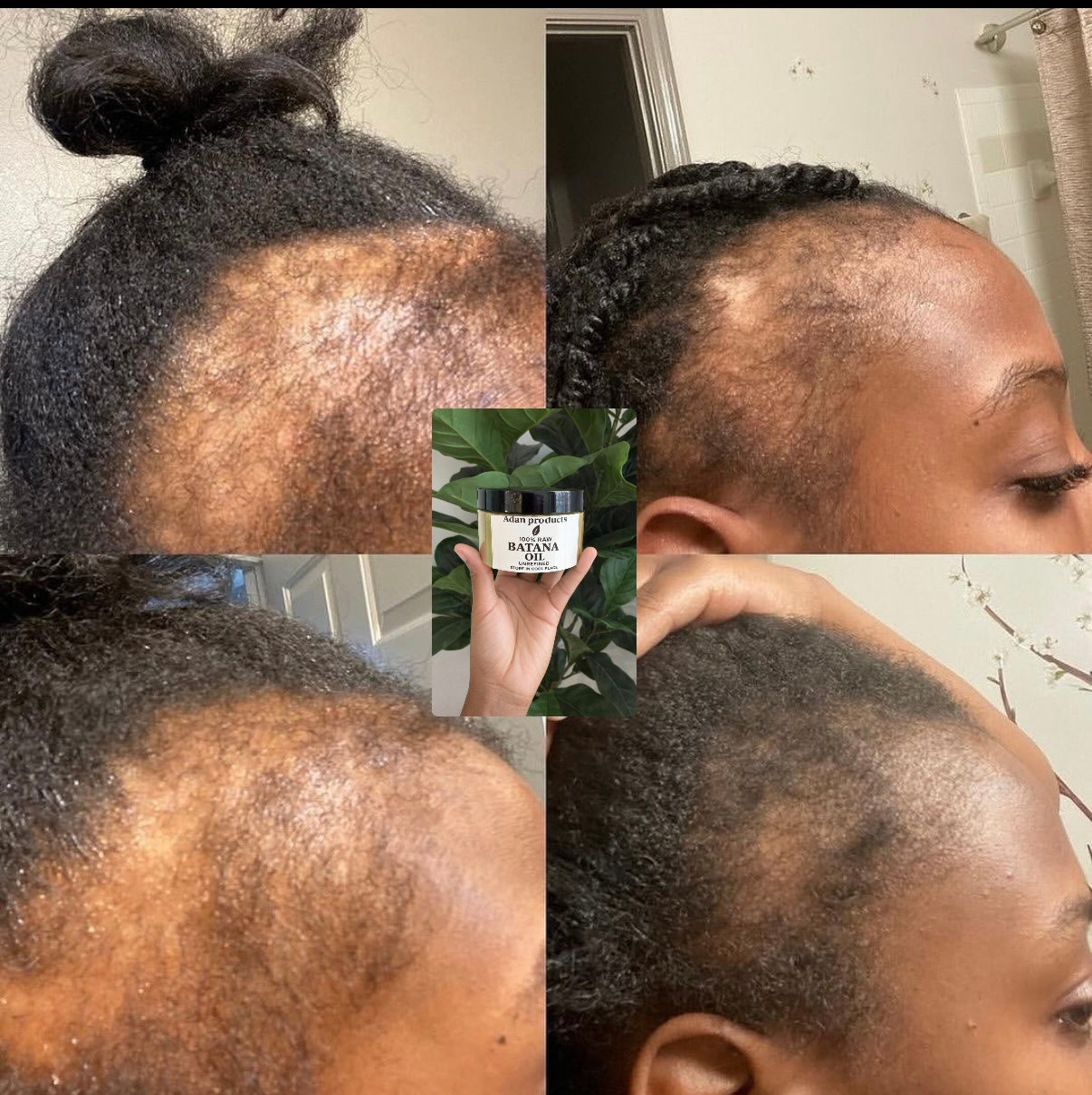 Adan Batana Oil for Hair Growth: Handmade in Honduras 100% Raw Batana Oil -