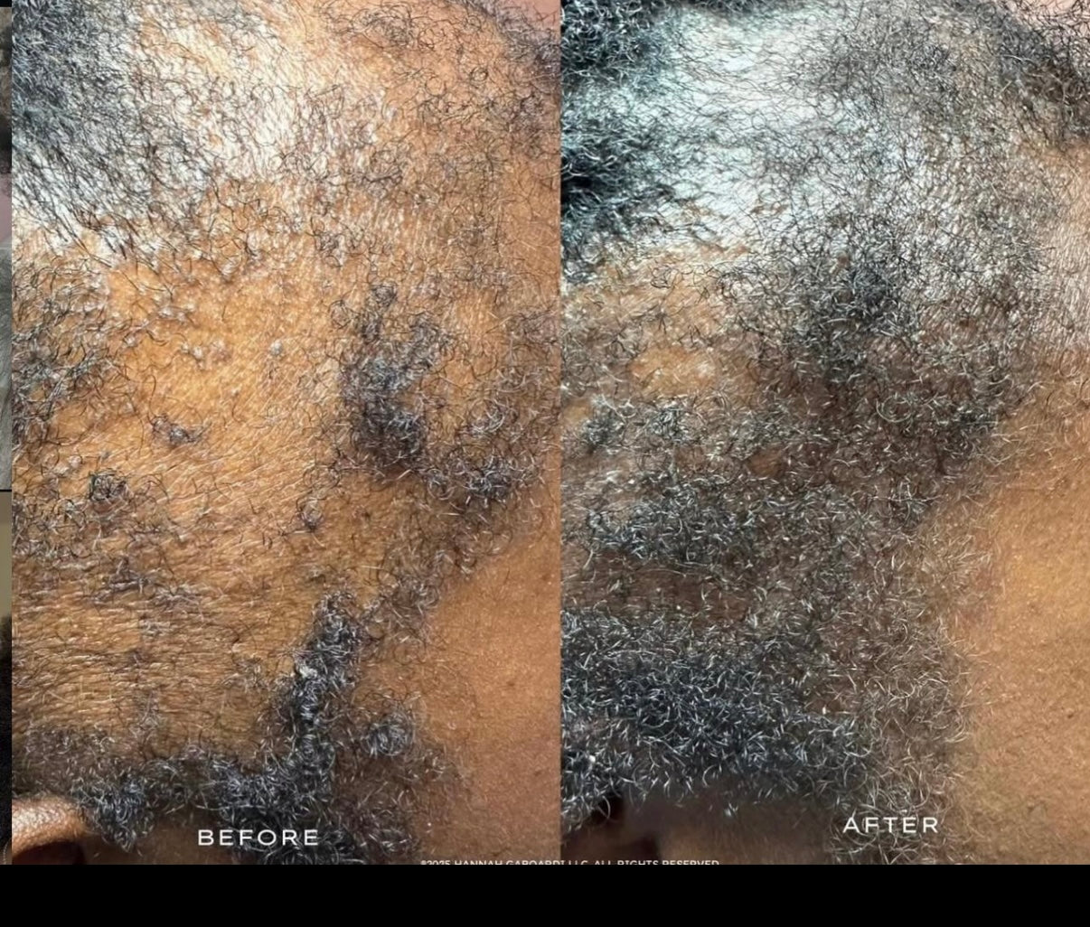 Batana Oil for Hair Growth: Handmade in Honduras 100% Raw Batana Oil -