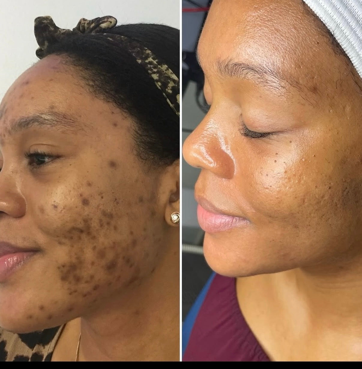 Adan Dark Spot + Glow Facial Oil | My Sister’s 20-Year Glow Secret (Fragrance free! )