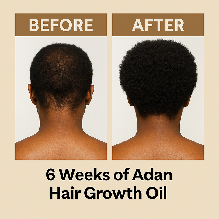Luxurious Organic Hair Growth Butter Infused With Chebe, Karkar Oil & Batana Oil