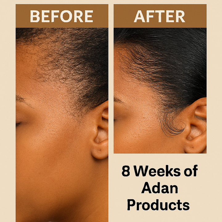 Luxurious Organic Hair Growth Butter Infused With Chebe, Karkar Oil & Batana Oil